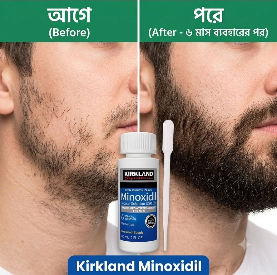 Kirkland Minoxidil 5% Solution (60ml) – 1 Month Supply for Hair Regrowth | Original USA Formula in Bangladesh