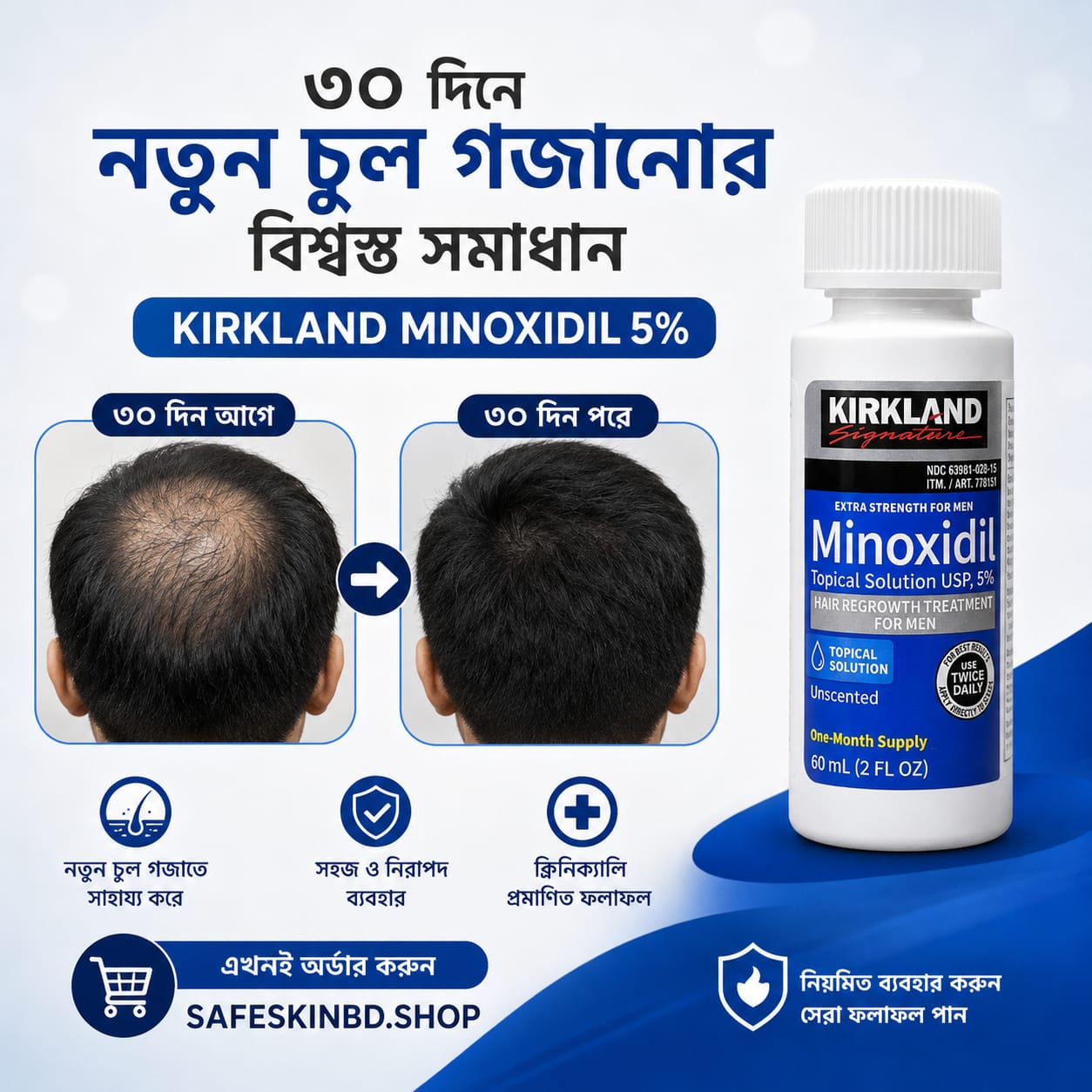 Kirkland 5% Minoxidil Hair Regrowth Treatment 60ml