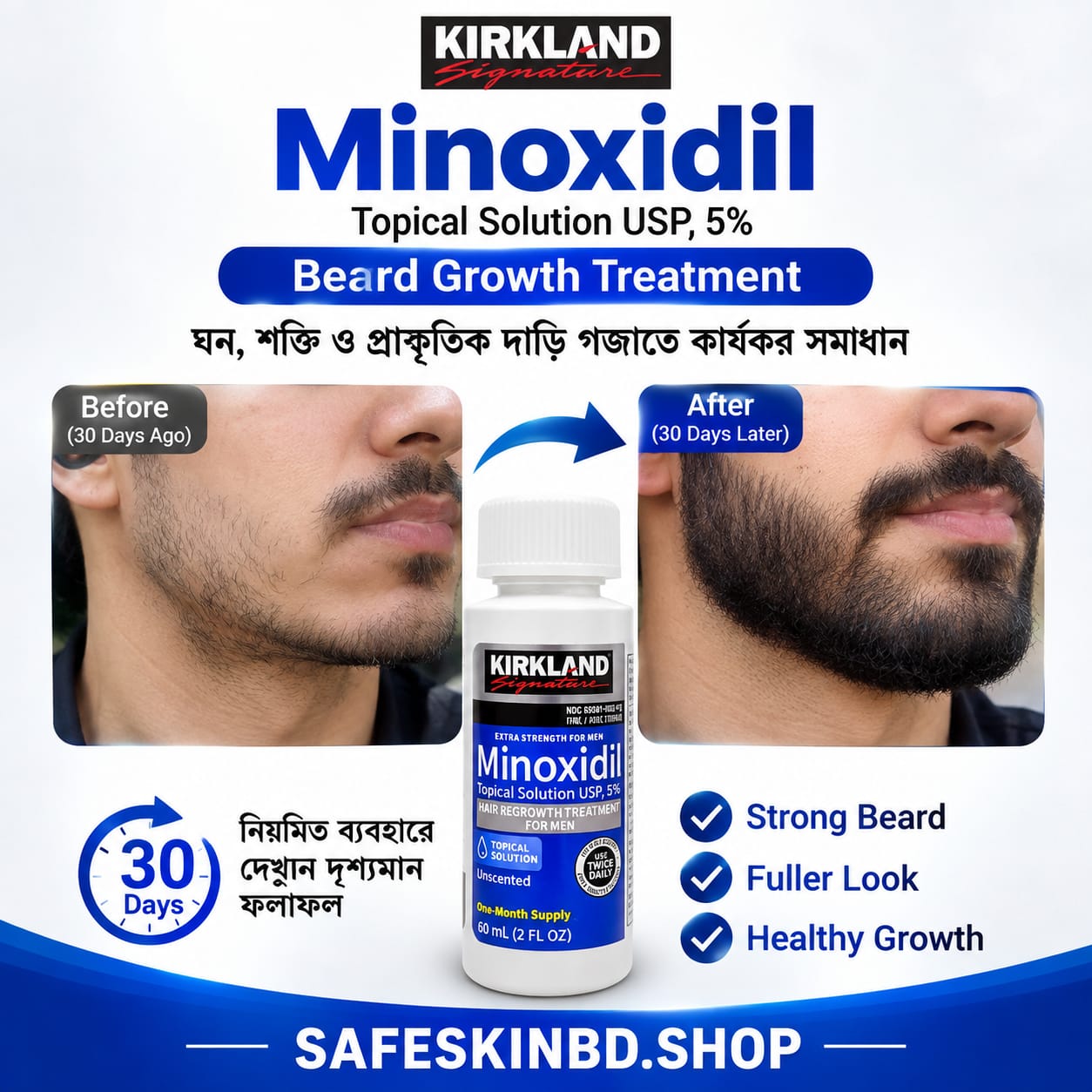 Kirkland 5% Minoxidil Hair Regrowth Treatment 60ml