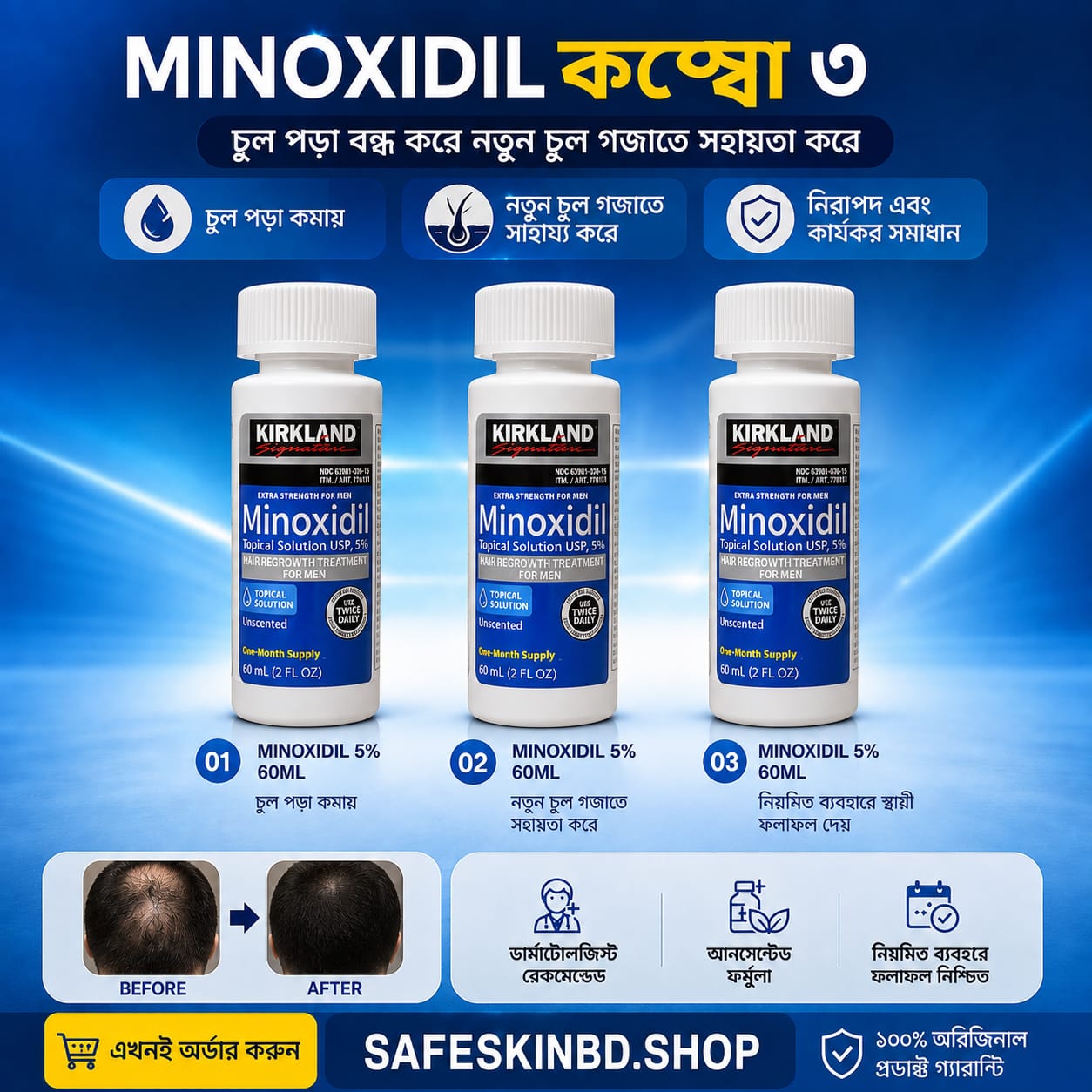 Kirkland Minoxidil 5% solution 60ml | 3 bottle combo pack