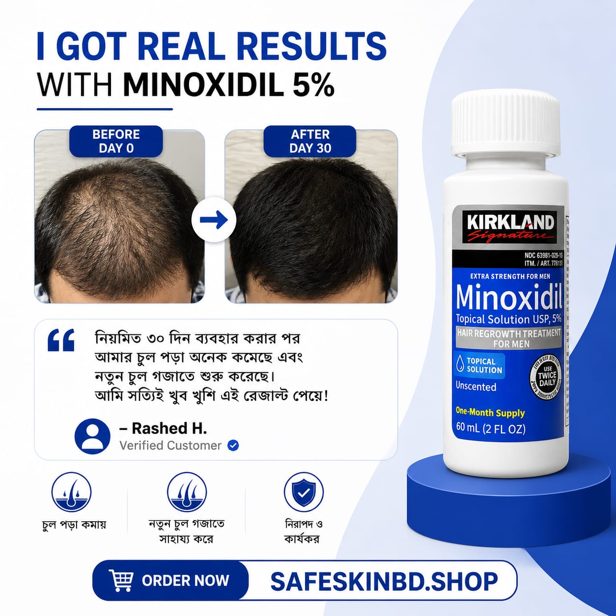 Kirkland 5% Minoxidil Hair Regrowth Treatment 60ml